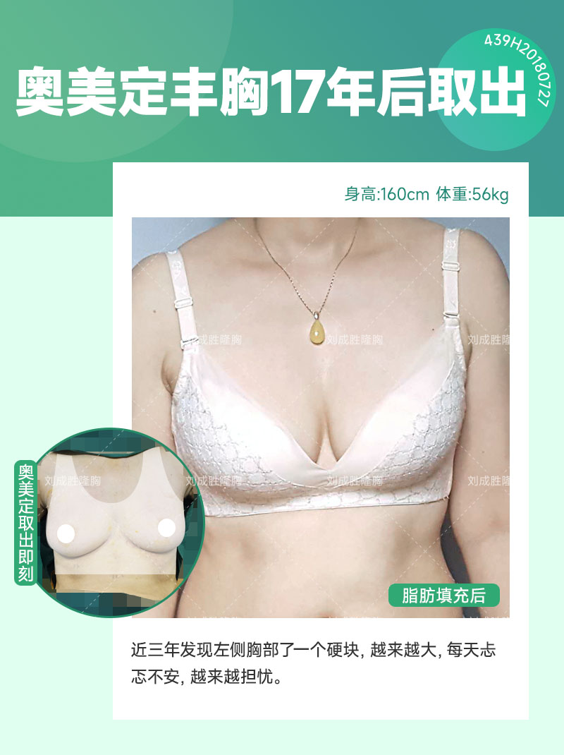 丰体针丰胸可能引发的身体不适，早预防早治疗